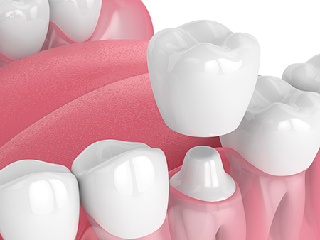 Dental Depot